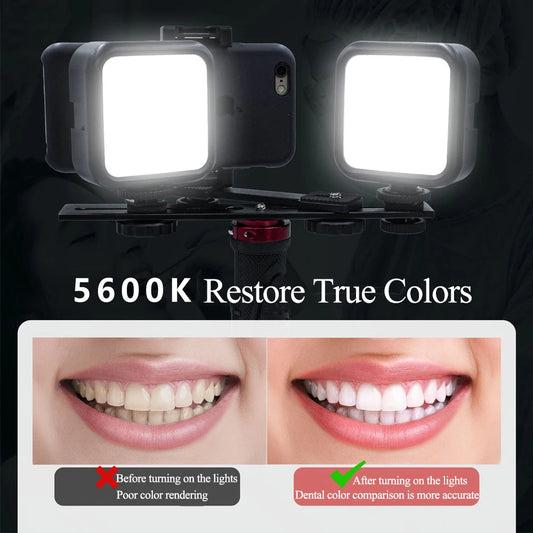 Purilite Select Dental Photography Light for Phone with Bluetooth