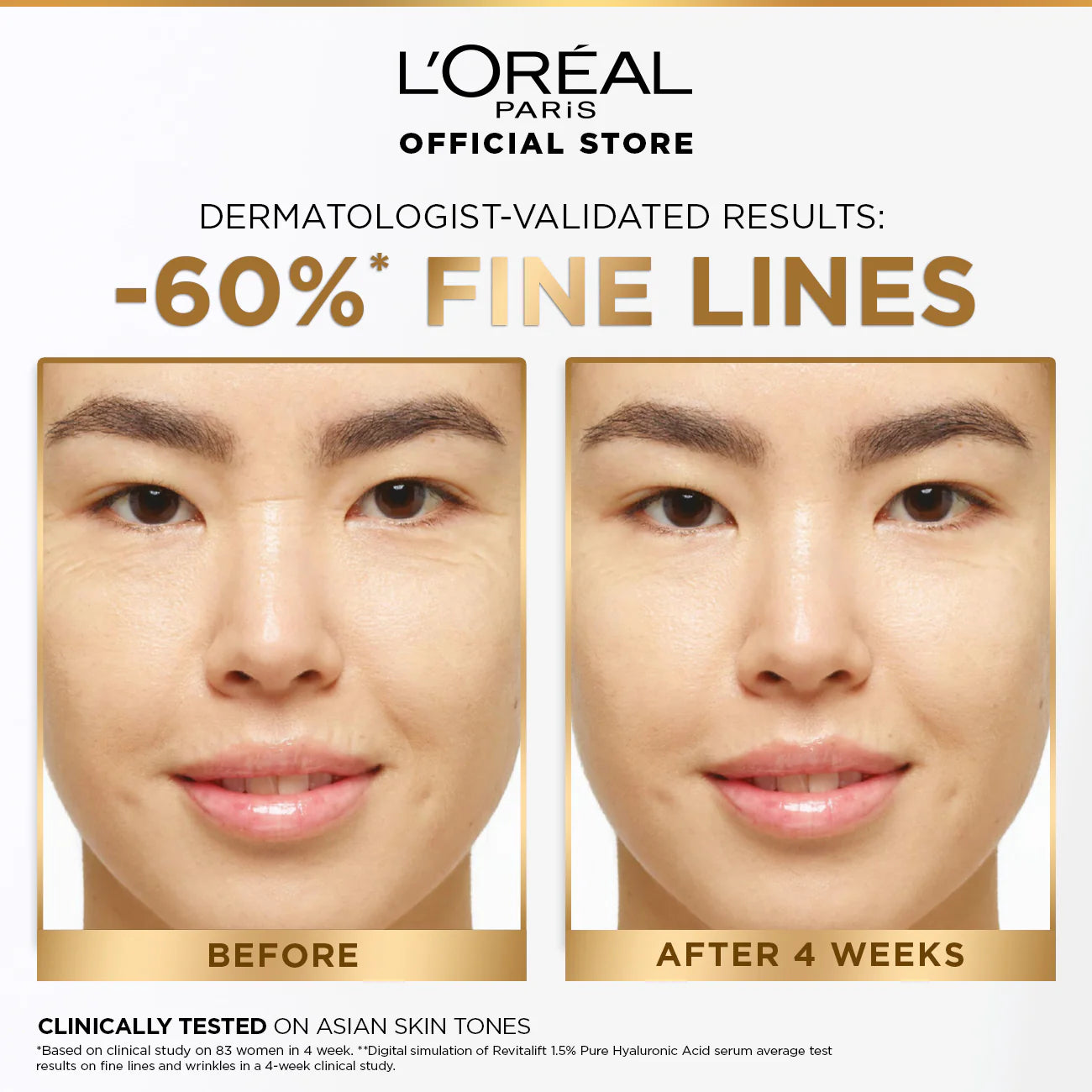 LOreal Paris - Revitalift 1.5% Hyaluronic Acid Face Serum 30 ML
