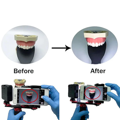 Purilite Select Dental Photography Light for Phone with Bluetooth